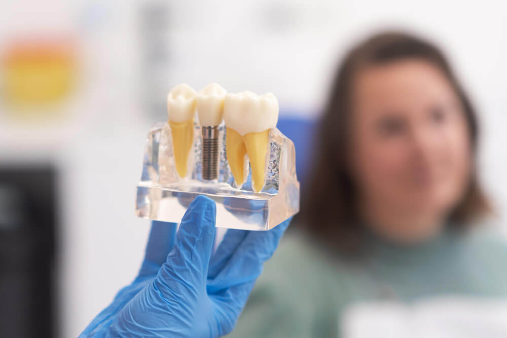 dientes con implante dental