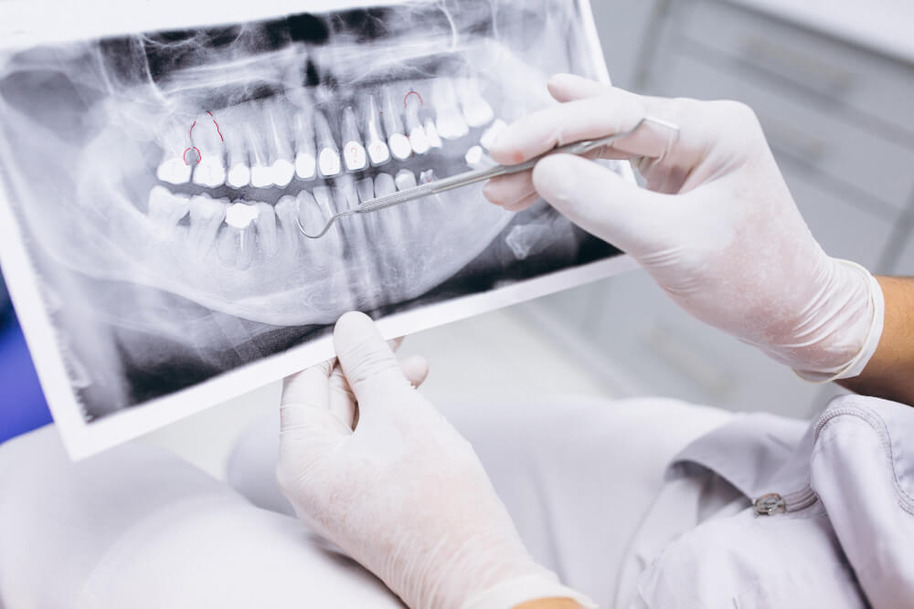 endodoncia