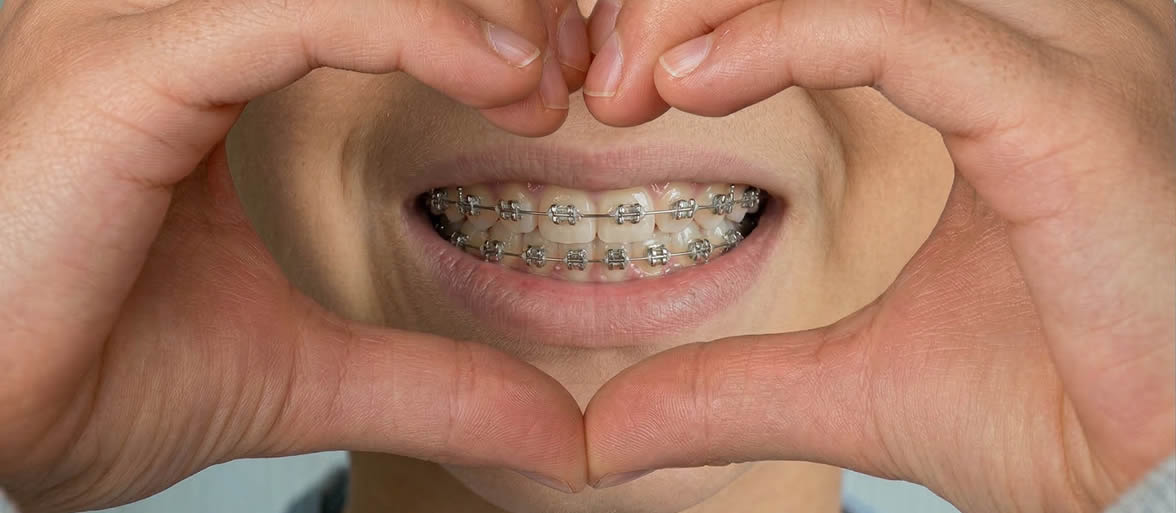 Ortodoncia en Zaragoza
